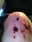 knee.JPG
